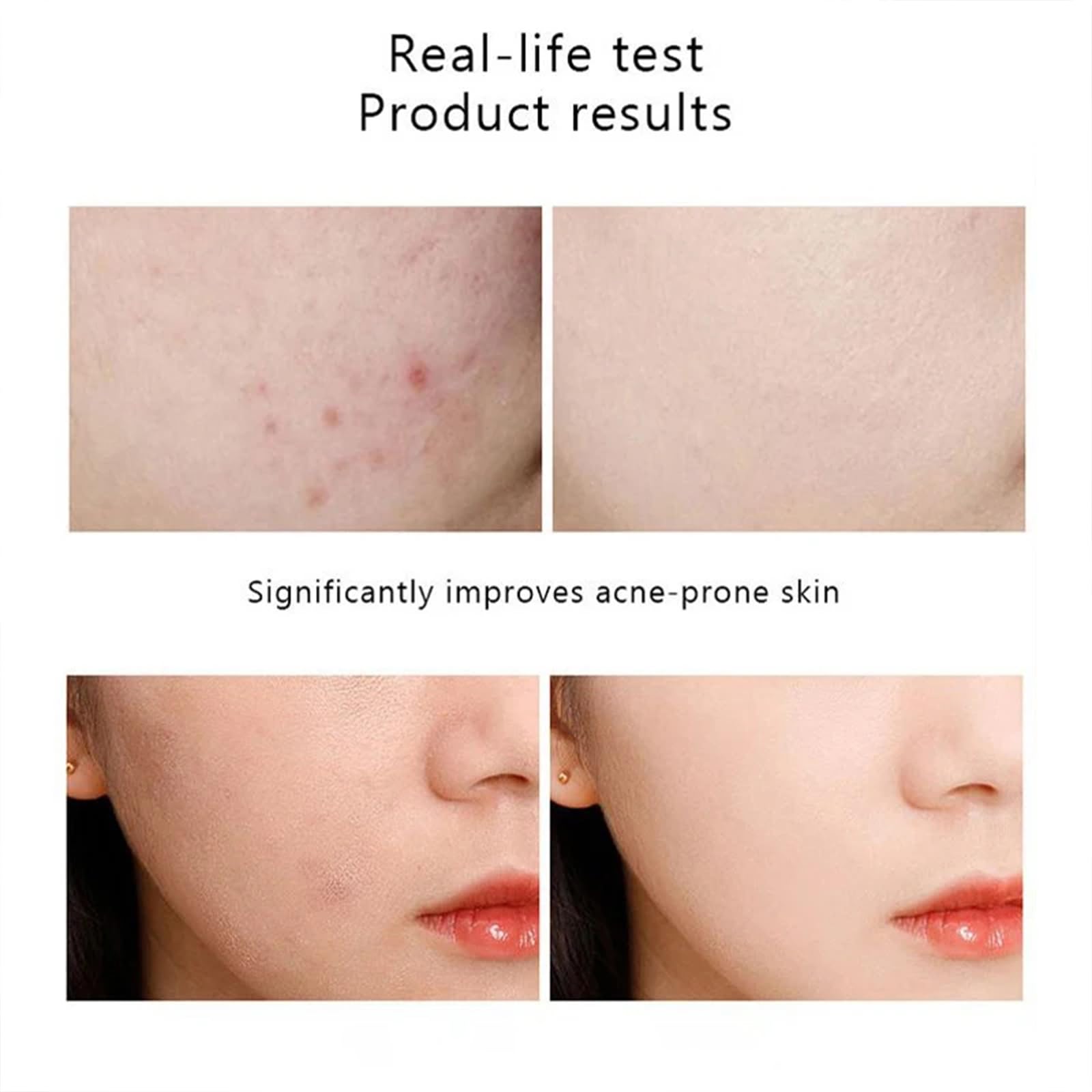 Niacinamide Serum for Face, 30ML/1 Fl Oz Niacinamide Face Serum for Women, Niacinamide 10% + Zinc 1% Serum For Acne.